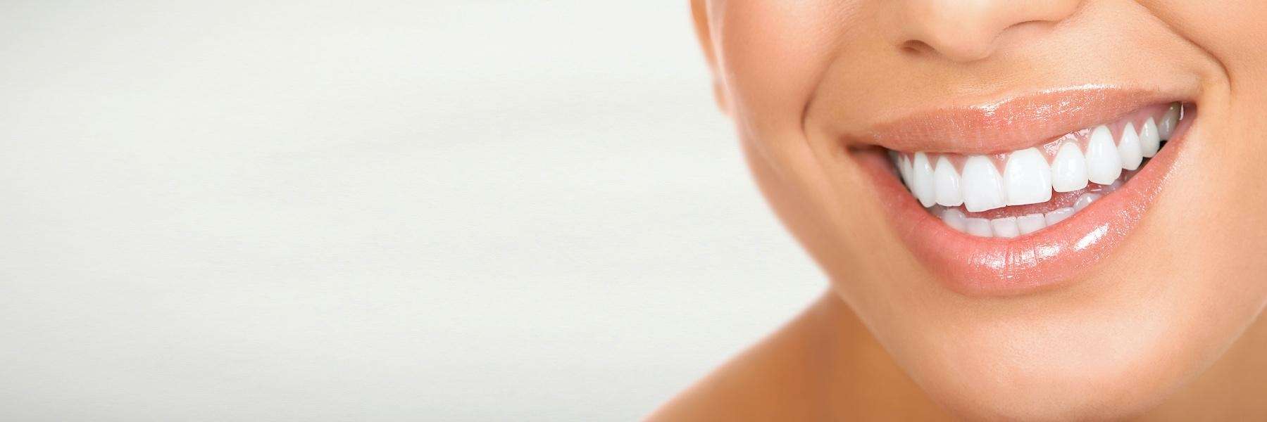 woman smiling | chelsea heights veneers