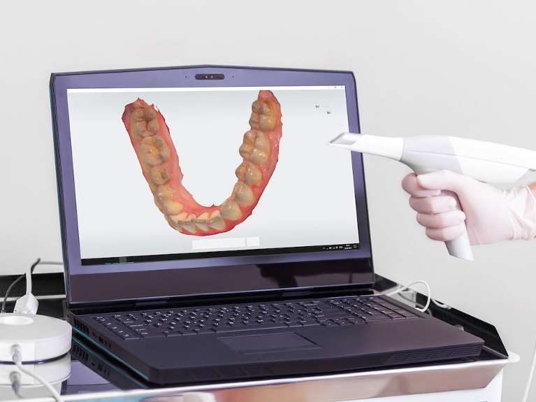 digital impressions | chelsea heights dentist