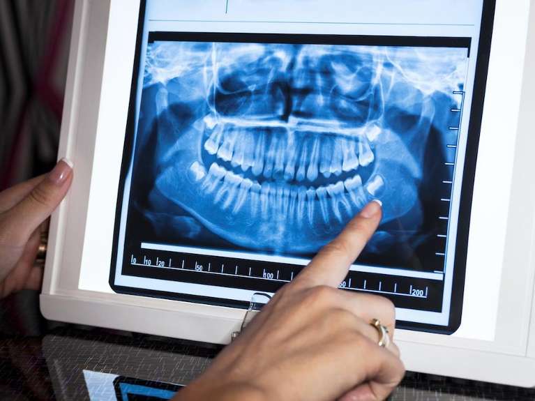 panoramic x-rays | dentist in chelsea heights